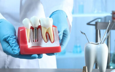 Best Dental Implant Clinic in South Extension