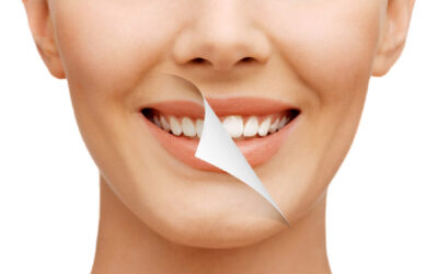 Best Smile Designing in South Extension for Optimal Digestive Health