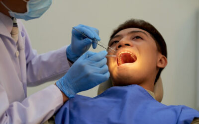 Best Tooth Coloured Fillings in South Extension: A Comprehensive Guide