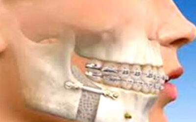 Best Maxillofacial Surgery in South Extension: Your Go-To Solution for Complex Facial Issues